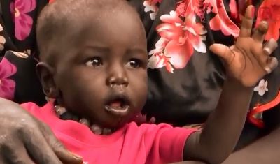 5 millones padecen hambruna en Sudán del Sur. VIDEO