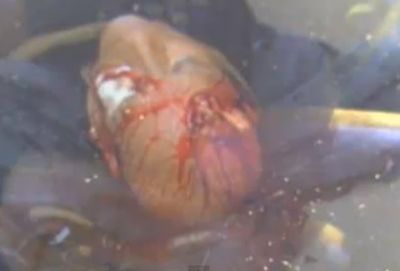 Hieren gravemente a joven #YoSoy132